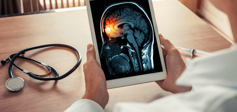 Bacterial Meningitis Misdiagnosis