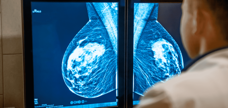 Failed to Notify of Positive Mammogram