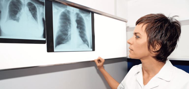 Failure to Diagnose Pulmonary Embolism