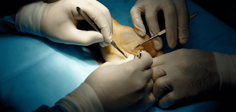 Nerve Damage Caused by Surgical Error