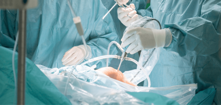 Surgeon Did a Bad Knee Replacement